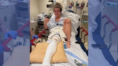 Alex Gazan smiles from a hospital bed with a fractured fibula.