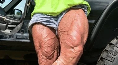 Quads